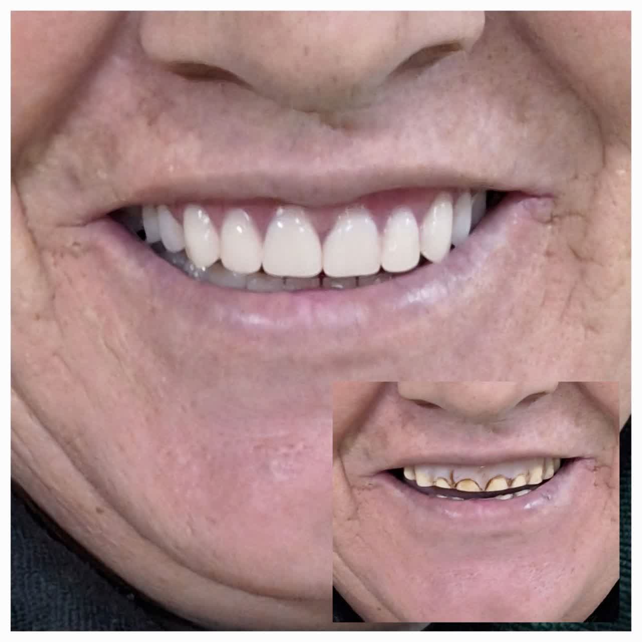 ساخت دندان