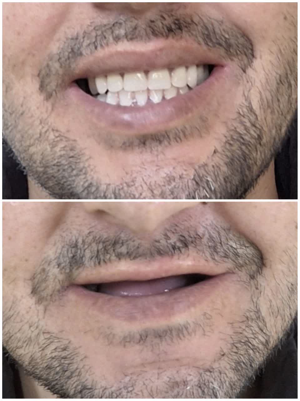 ساخت دندان