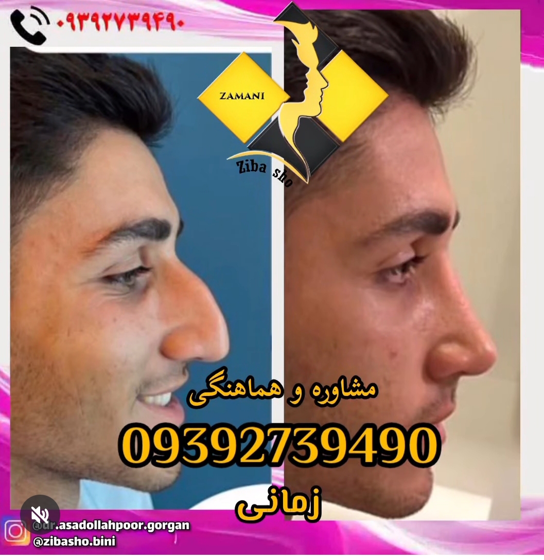گالری جراحی زیبایی