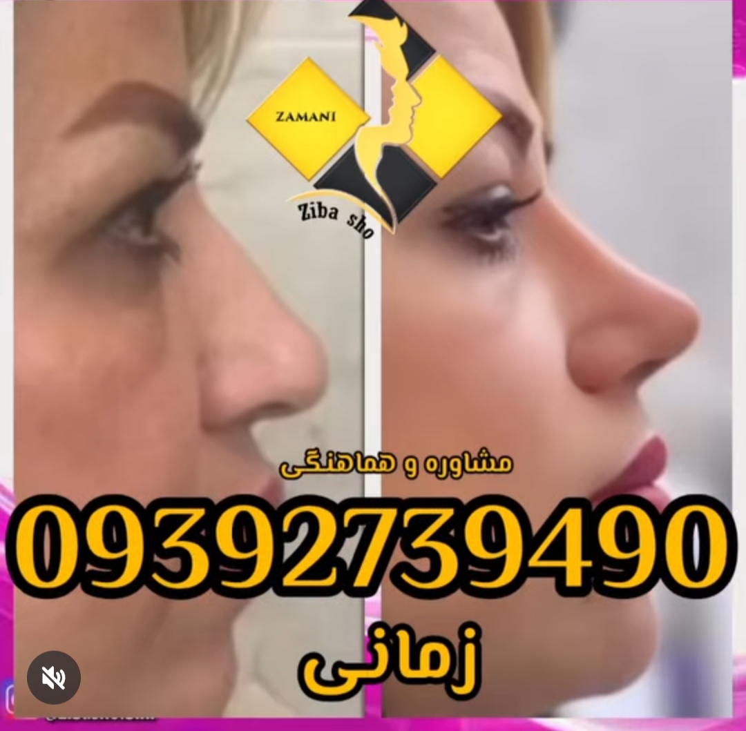 گالری جراحی زیبایی