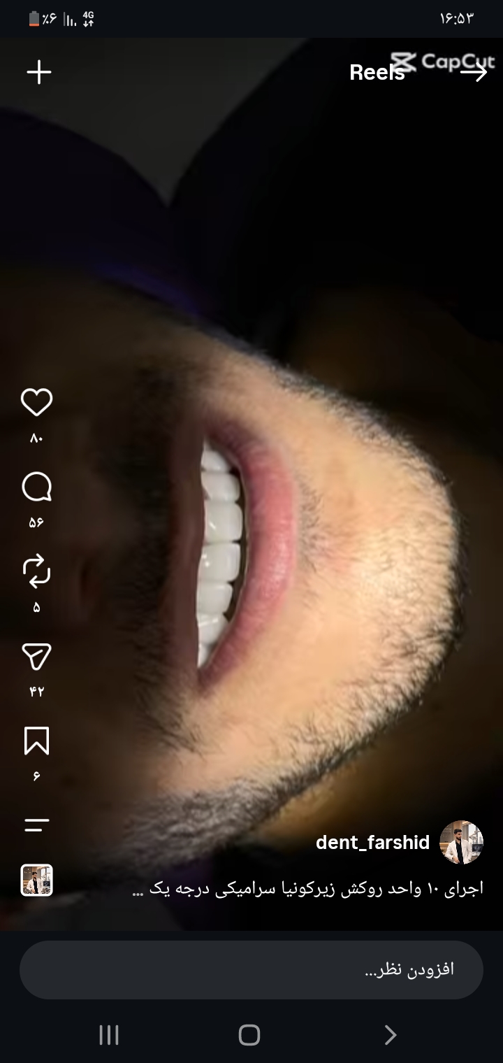 عکس بعد