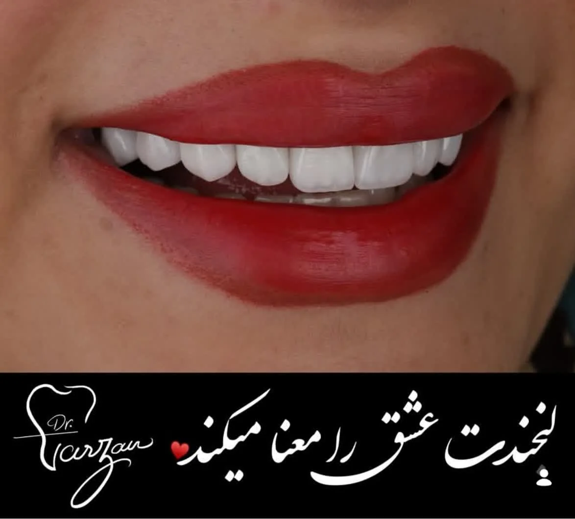 لوگو دندانپزشک - طراح دیجیتال لبخند و اجرا توسط ونیر کامپوزیت و لمینت سرامیکی