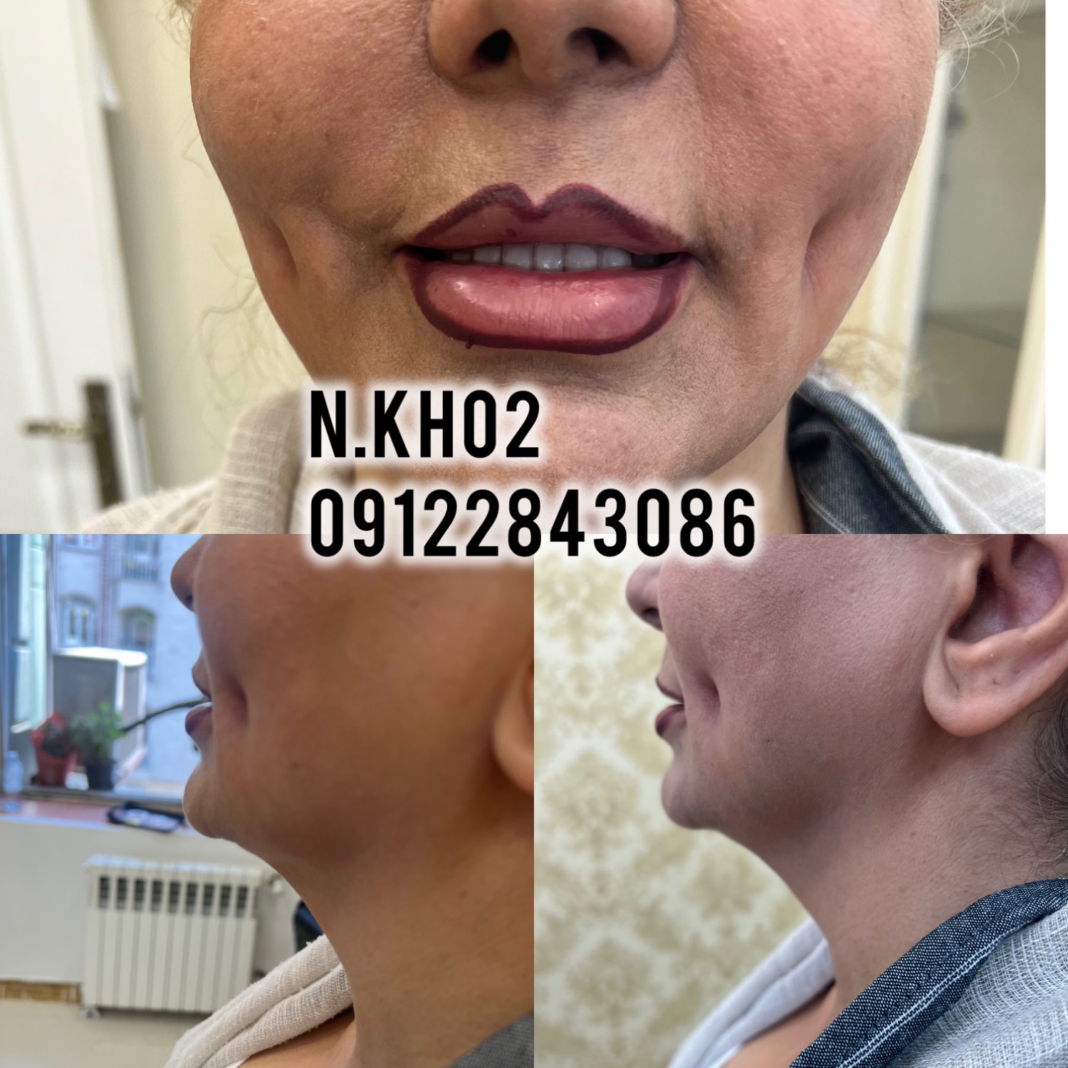 گالری خدمات پرسینگ و کراتین