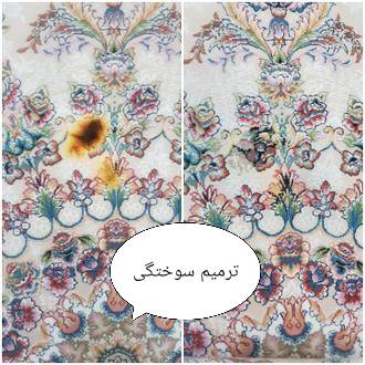 شستشوی  باکیفییتت