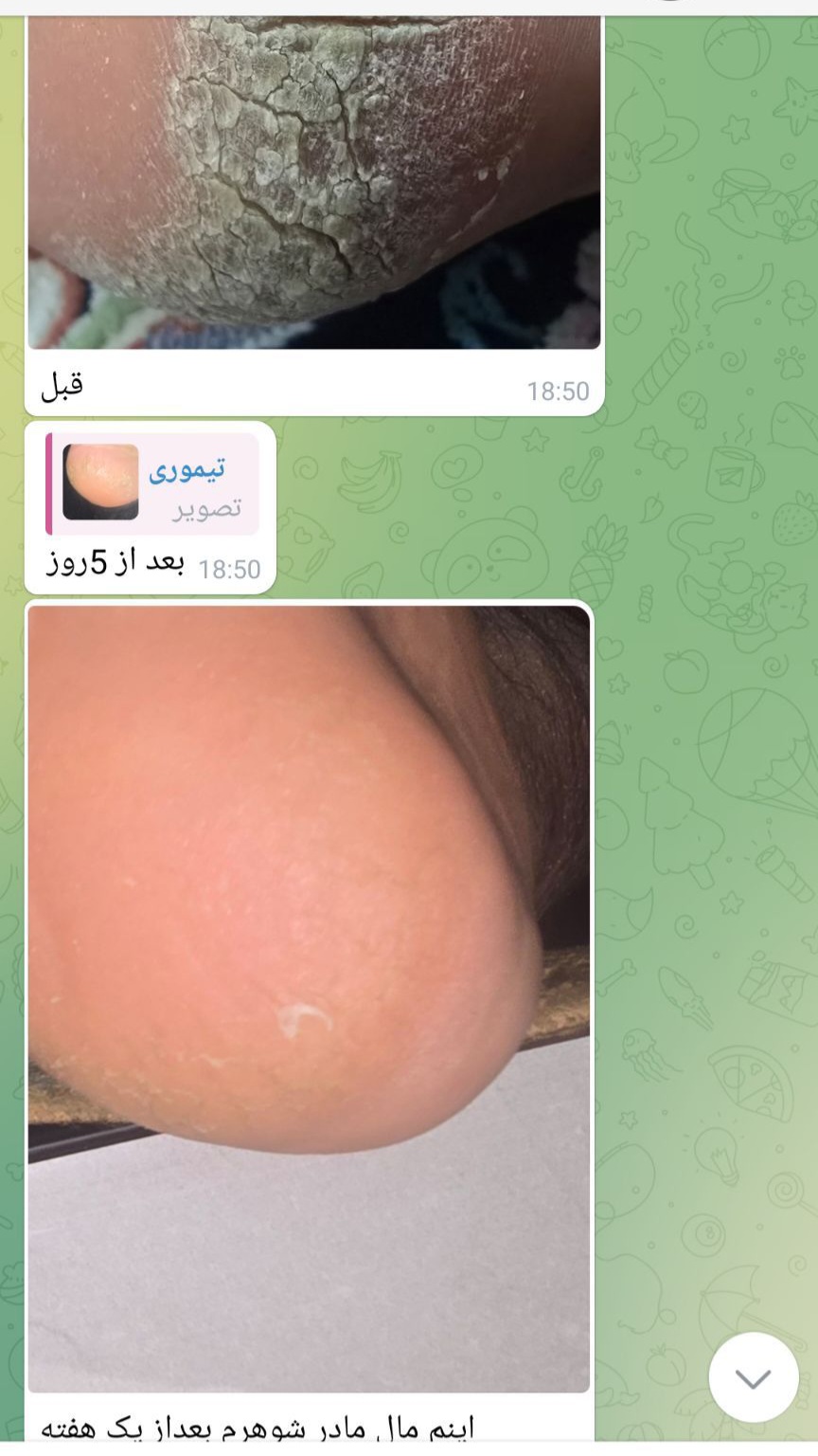 پمادهای گیاهی 