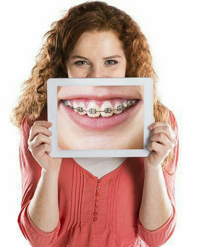 ارتودنسی ثابت یک فک