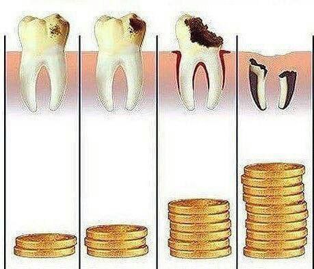 درمان ریشه یک کانال