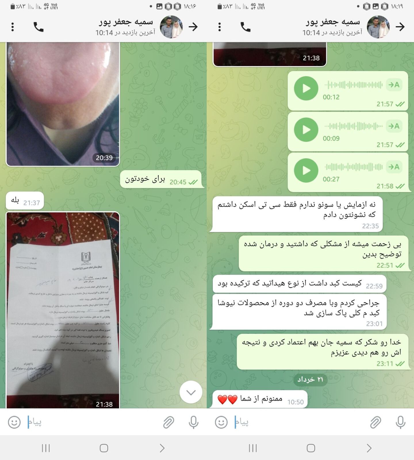 پاکسازی کیست کبد 